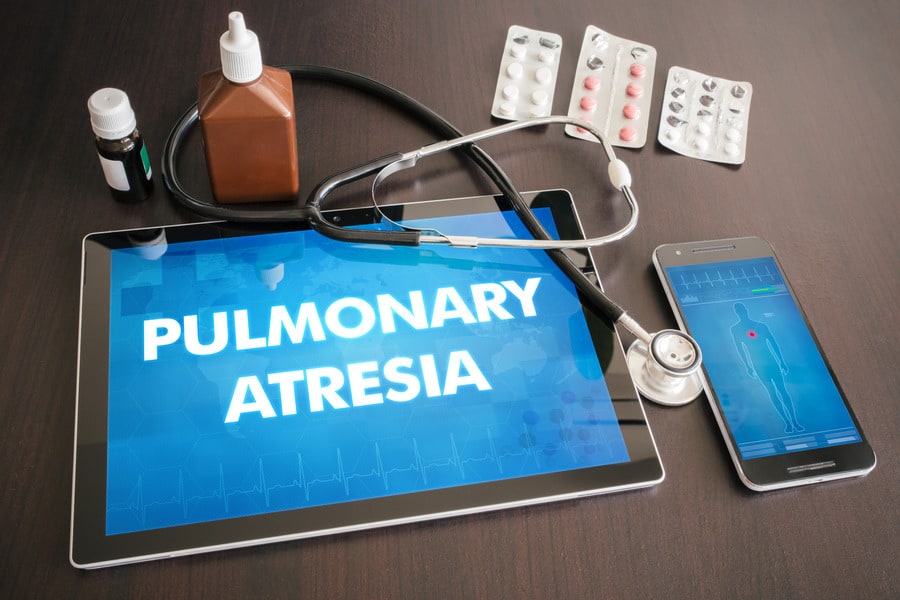 Pulmonary Atresia: Causes, Symptoms, and Treatment