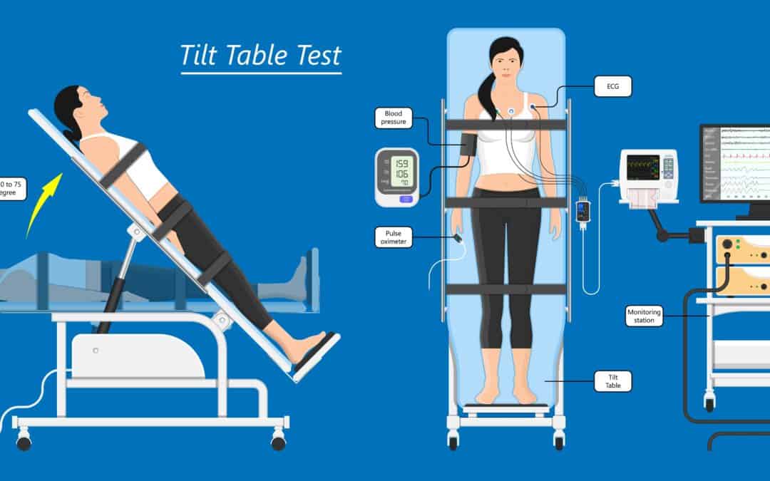 Tilt Table Testing: A Deep Dive into the Diagnostic Process