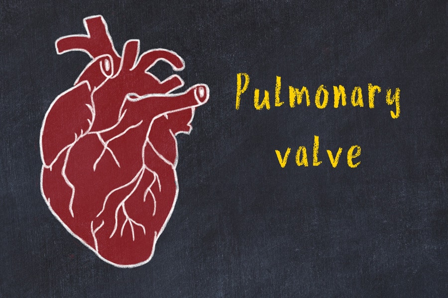 Pulmonary valve disease