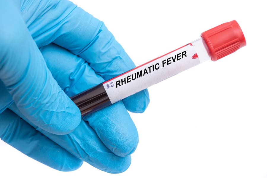 Rheumatic Fever: Causes, Symptoms, and Prevention