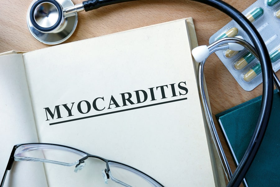 Understanding Myocarditis: Causes, Symptoms, and Management